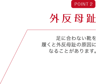 POINT 2 外反母趾 足に合わない靴を履くと外反母趾の原因になることがあります。