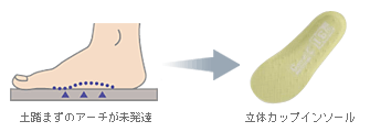 立体カップインソール図解